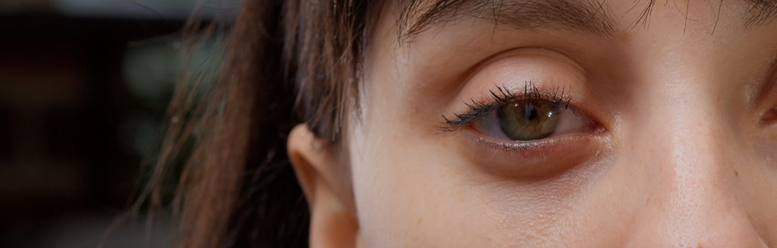 Vis Activ neo - gotas para ojos secos y alergia en los ojos 