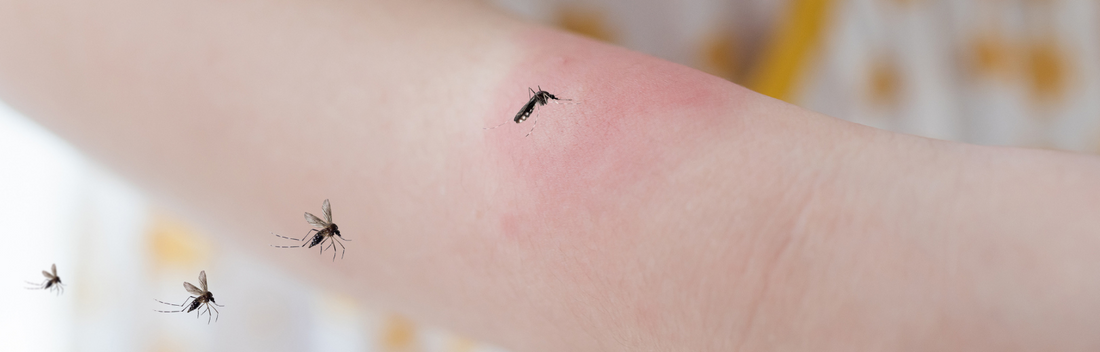 ¿Cómo aliviar la picadura de mosquito?