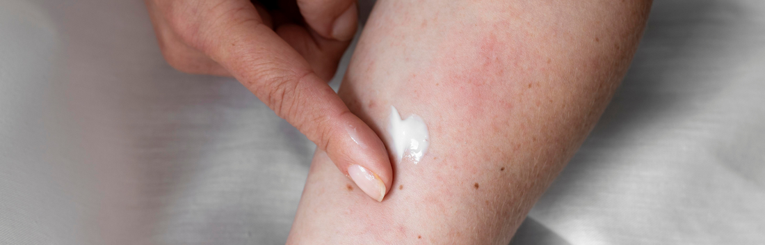 Tiene la Dermatitis seborreica una causa interna? Las respuestas