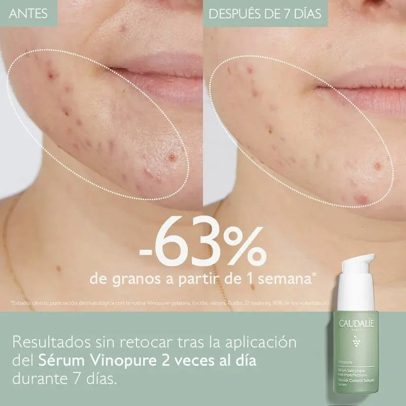 Caudalíe Vinopure Sérum Salicílico Anti-Imperfecciones - 30 ml