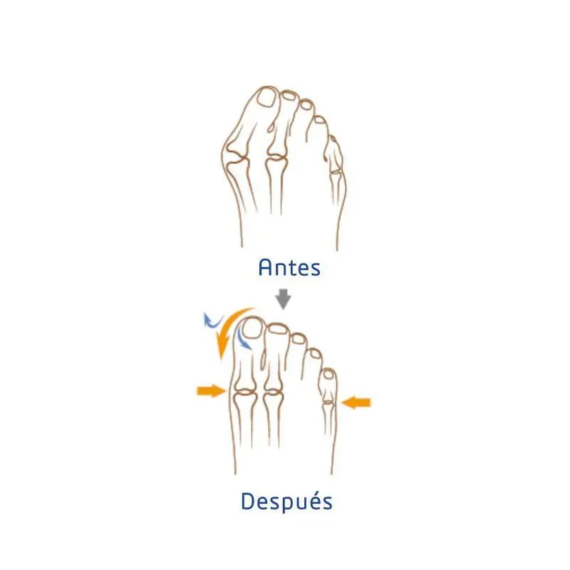 García 1880 Corrector Hallux Valgus Derecha Talla L/Xl