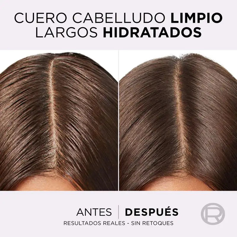 L'Oréal Paris Elvive Champú Hialuronico Pure: Limpia, Hidrata, Cabello Con Cuerpo Y Brillo, Sin Siliconas, 400Ml