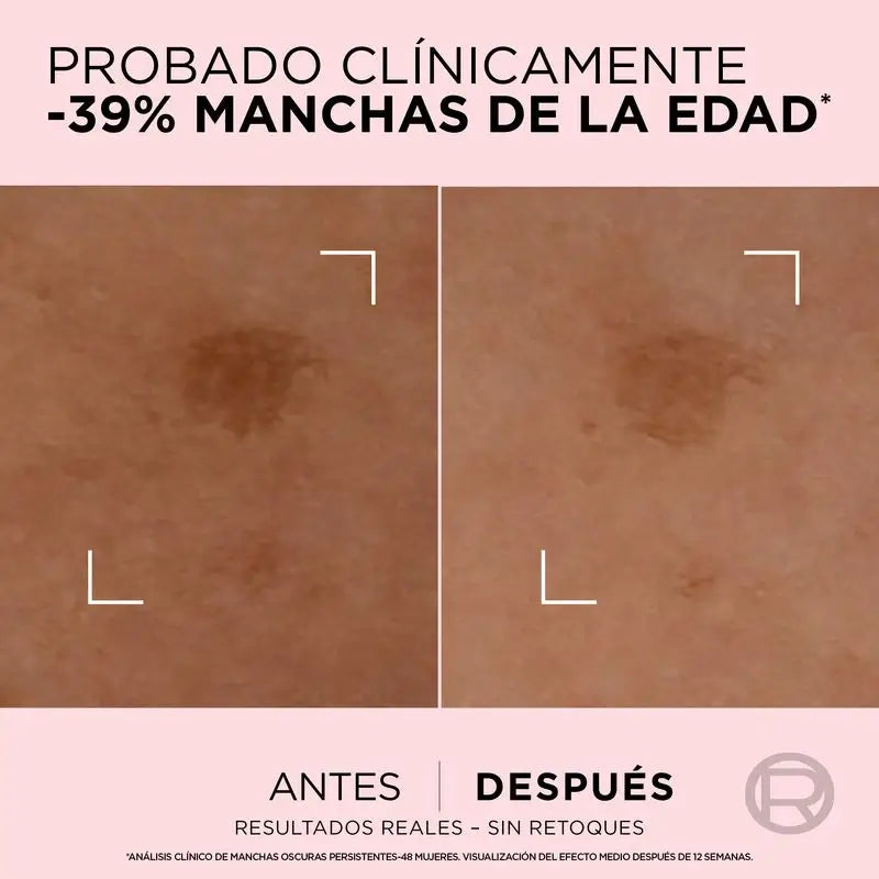 L'Oréal Paris Age Perfect Serum Corrector Acción Rápida Anti-Manchas Para Pieles Maduras