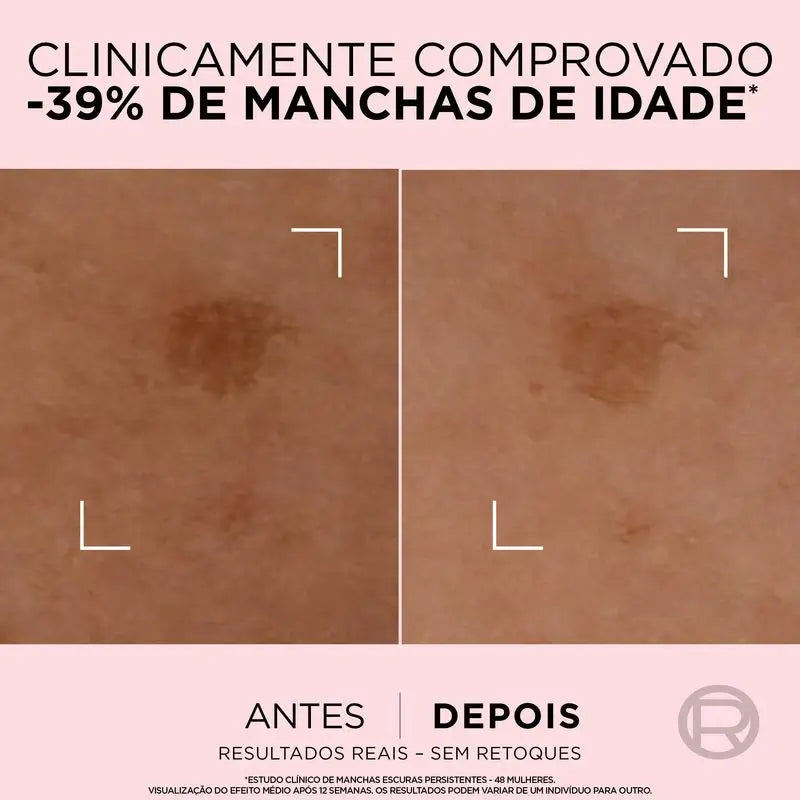 L'Oréal Paris Age Perfect Serum Corrector Acción Rápida Anti-Manchas Para Pieles Maduras